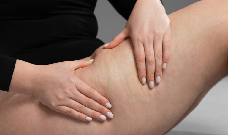 Presoterapia y celulitis cómo mejorar el aspecto de la piel de forma eficaz y no invasiva